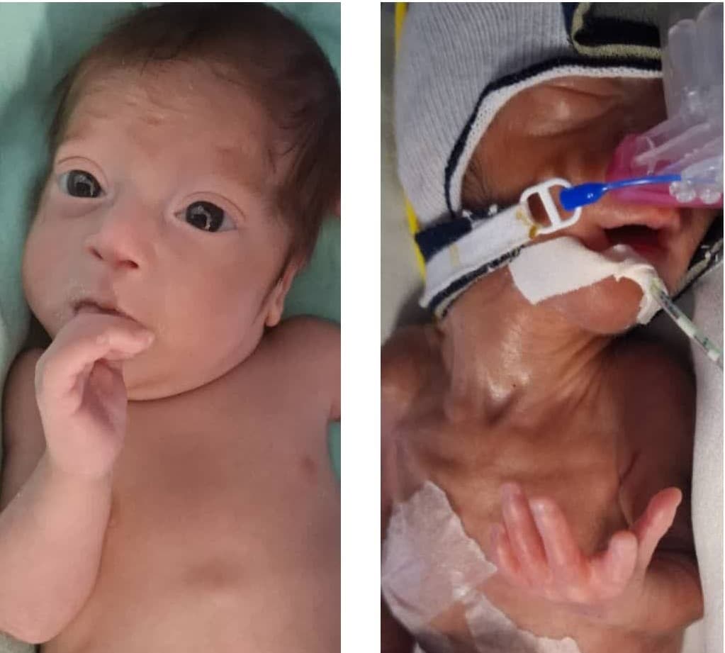 معجزه زندگی در بیمارستان غرضی اصفهان؛ ترخیص نوزاد نارس پس از ۸۰ روز