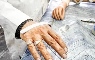 کمکهزینههای پروتز و اروتز چگونه محاسبه میشود؟